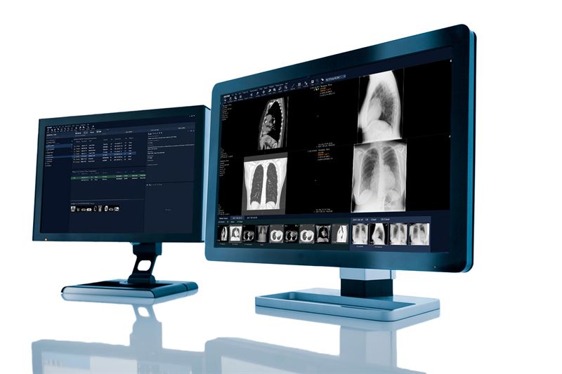 Danmarks största region förbättrar bilddiagnostik inom sjukvården med IT-lösning från Sectra