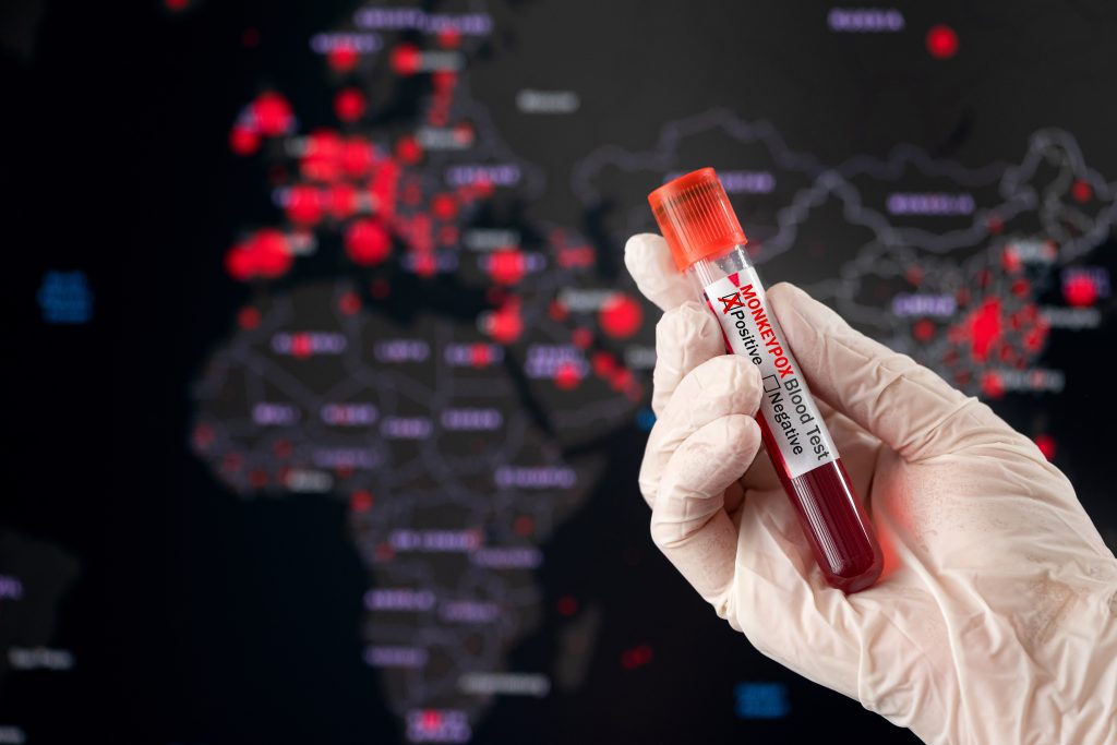 Konstaterat fall av mpox klad 1 – Regeringen kallar till krismöte